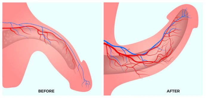 Before and after circulation illustration